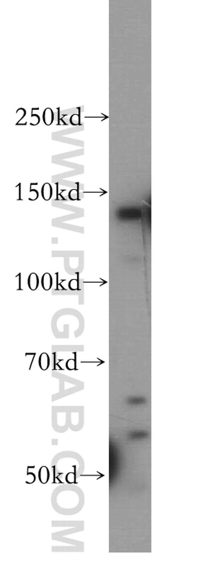 SFI1 Antibody in Western Blot (WB)