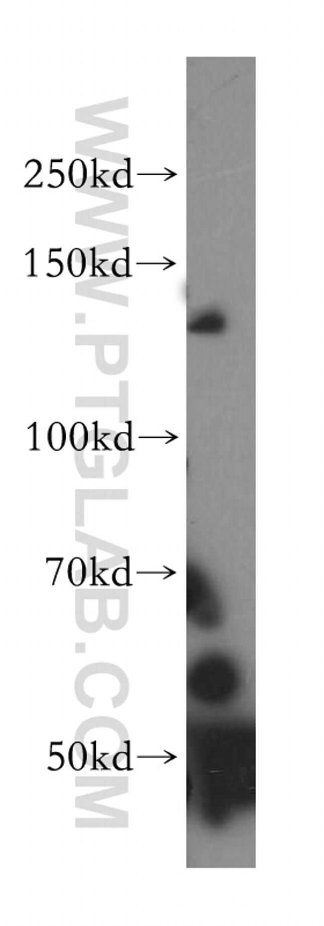 SFI1 Antibody in Western Blot (WB)