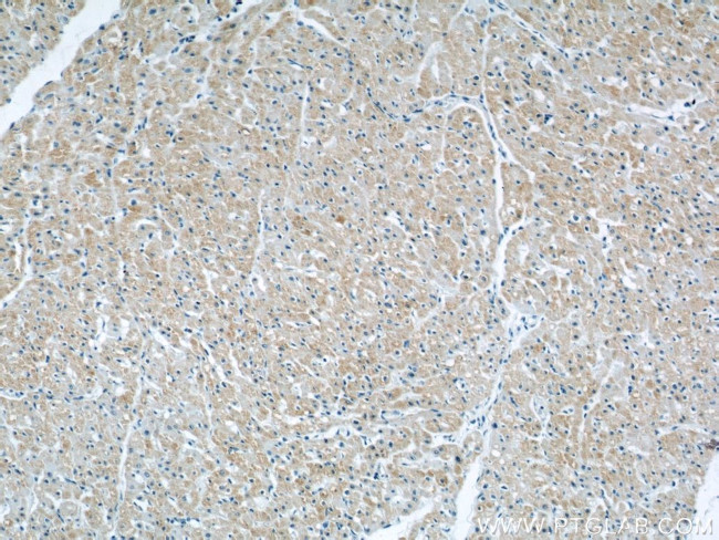 CYP2J2 Antibody in Immunohistochemistry (Paraffin) (IHC (P))