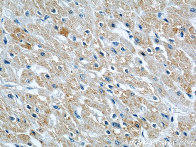 CYP2J2 Antibody in Immunohistochemistry (Paraffin) (IHC (P))