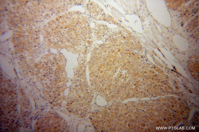 CYP2J2 Antibody in Immunohistochemistry (Paraffin) (IHC (P))