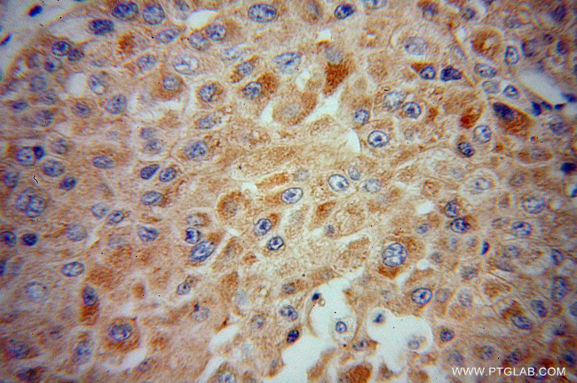 CYP2J2 Antibody in Immunohistochemistry (Paraffin) (IHC (P))