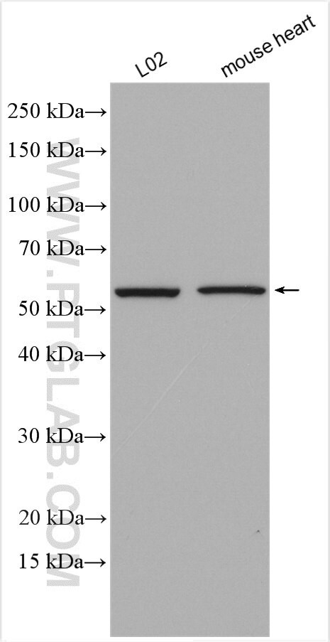 CYP2J2 Antibody in Western Blot (WB)