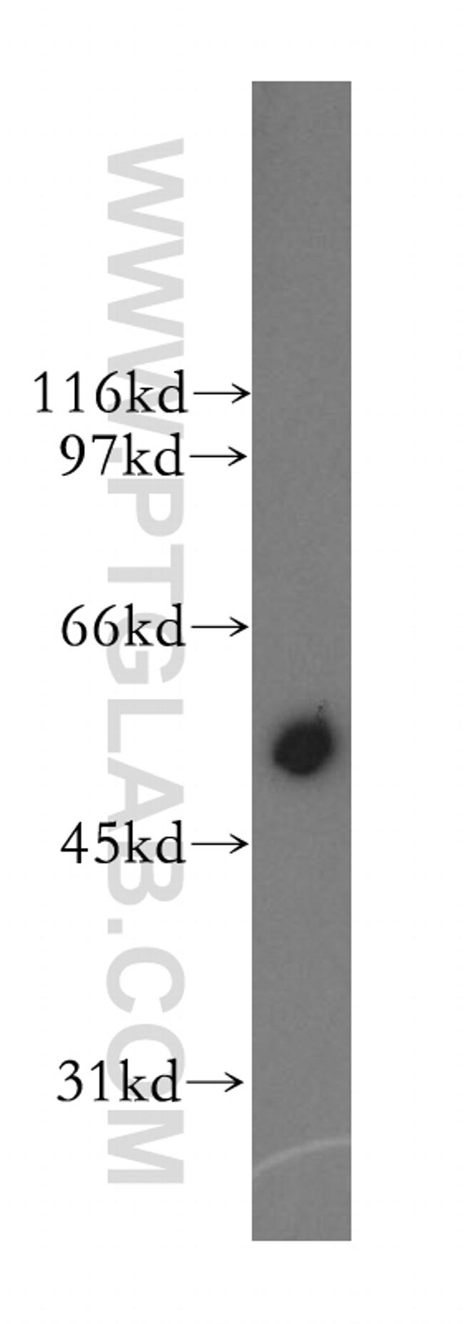 CYP2J2 Antibody in Western Blot (WB)