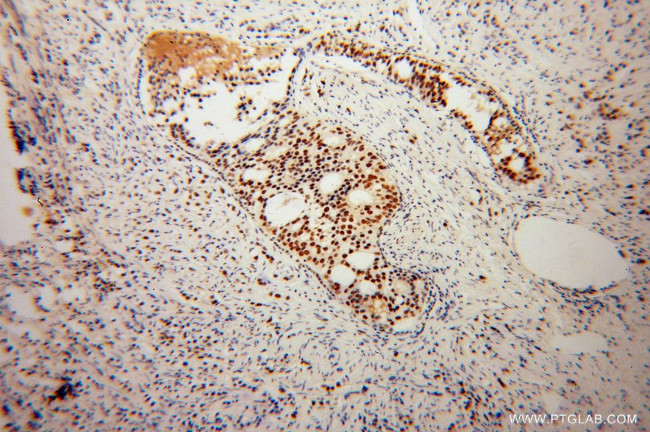 KHDRBS3 Antibody in Immunohistochemistry (Paraffin) (IHC (P))