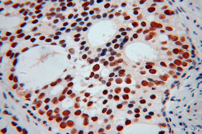 KHDRBS3 Antibody in Immunohistochemistry (Paraffin) (IHC (P))