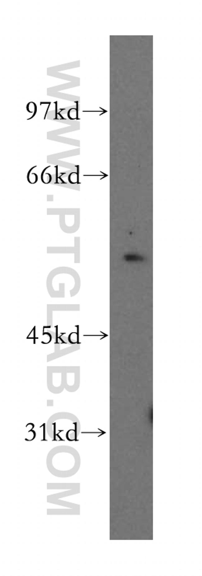 KHDRBS3 Antibody in Western Blot (WB)