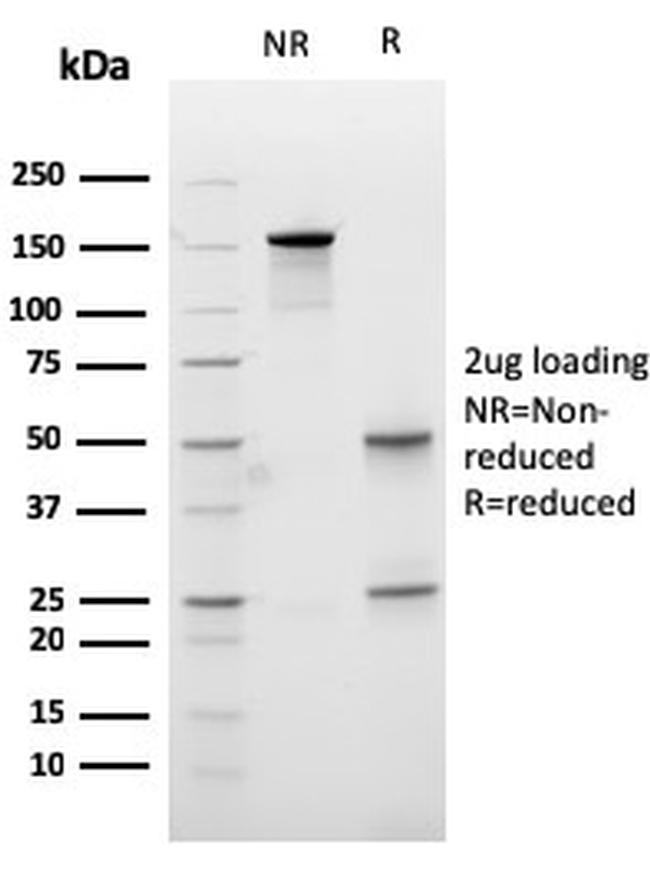 Carboxypeptidase A1/CPA1 Antibody in SDS-PAGE (SDS-PAGE)