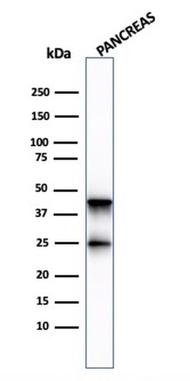 Carboxypeptidase A1/CPA1 Antibody in Western Blot (WB)