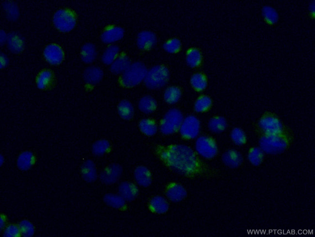 ARFGAP1 Antibody in Immunocytochemistry (ICC/IF)