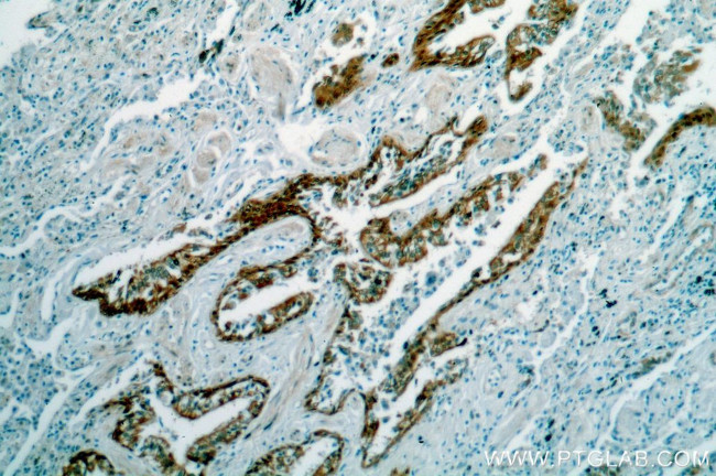 HSPA6 Antibody in Immunohistochemistry (Paraffin) (IHC (P))