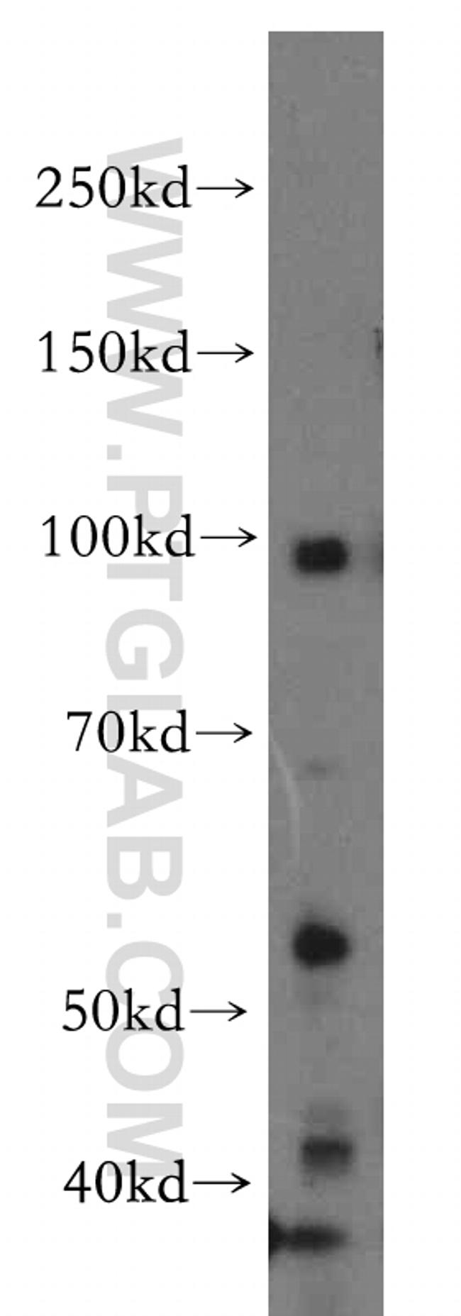 UIMC1 Antibody in Western Blot (WB)