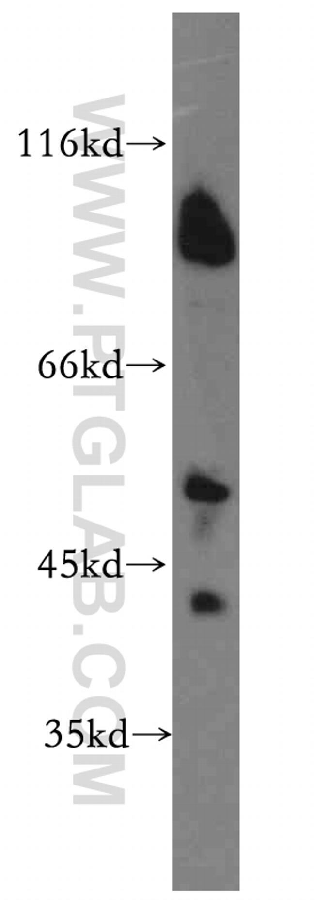 UIMC1 Antibody in Western Blot (WB)