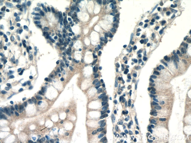 ENTPD2 Antibody in Immunohistochemistry (Paraffin) (IHC (P))