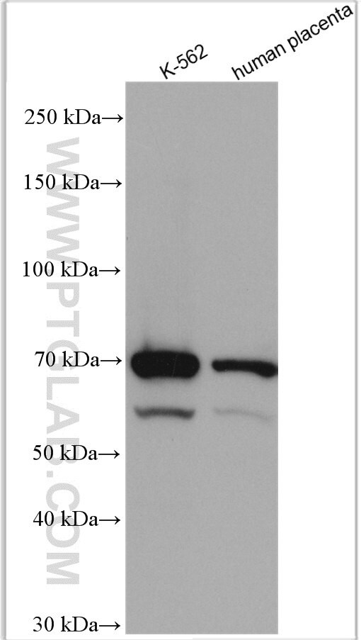 ENTPD2 Antibody in Western Blot (WB)