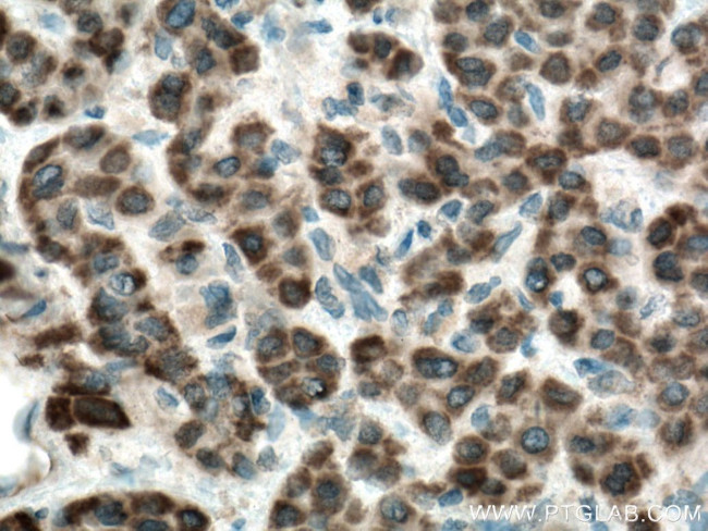 SLC35A2 Antibody in Immunohistochemistry (Paraffin) (IHC (P))