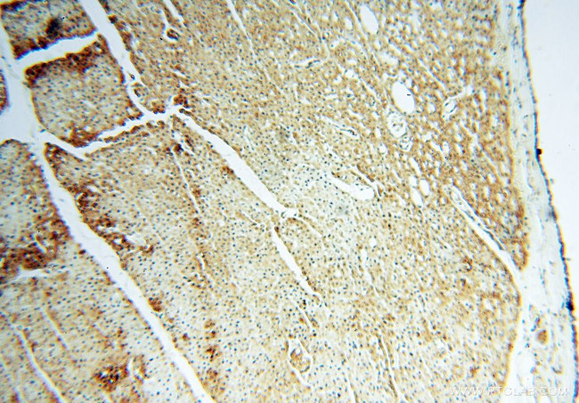 SFTPB Antibody in Immunohistochemistry (Paraffin) (IHC (P))