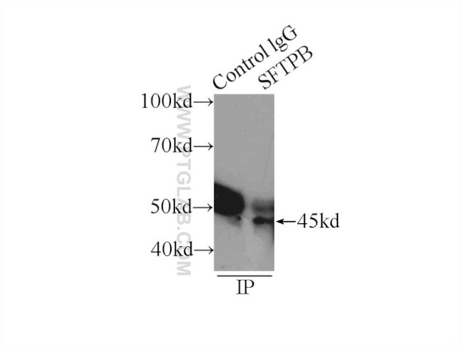 SFTPB Antibody in Immunoprecipitation (IP)