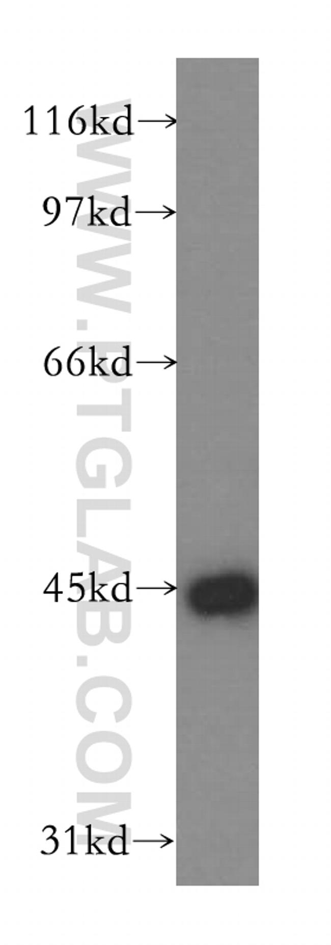 SFTPB Antibody in Western Blot (WB)