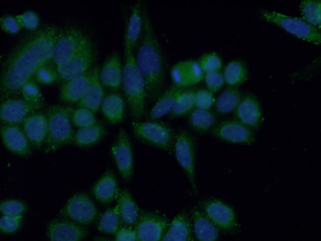 CA7 Antibody in Immunocytochemistry (ICC/IF)