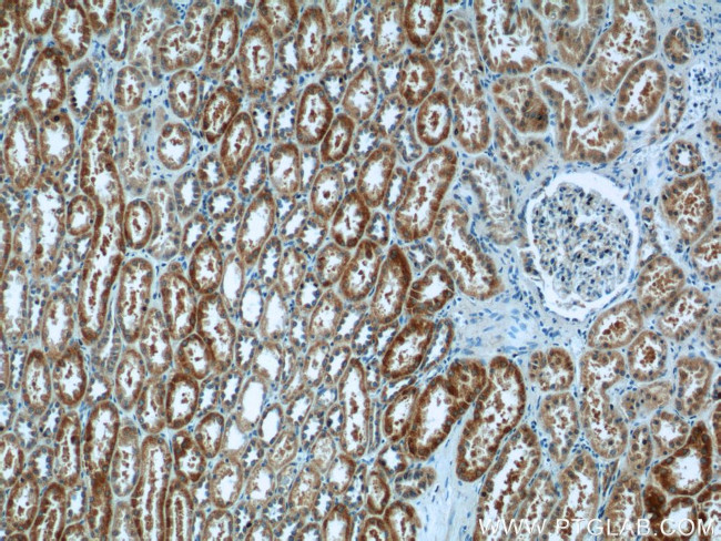 CA7 Antibody in Immunohistochemistry (Paraffin) (IHC (P))