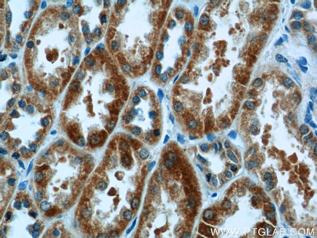 CA7 Antibody in Immunohistochemistry (Paraffin) (IHC (P))