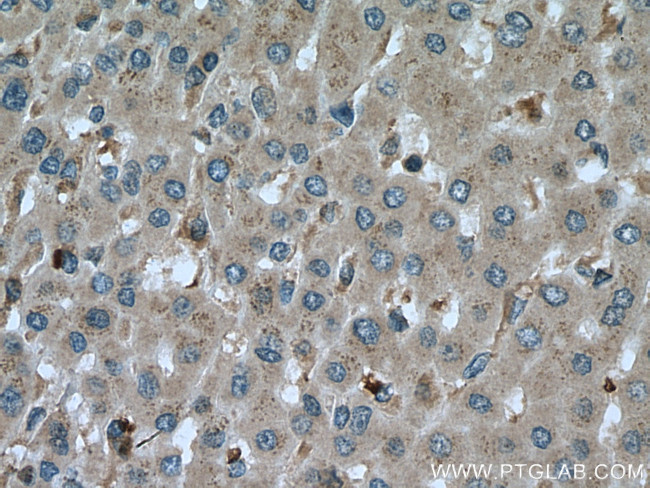 CA7 Antibody in Immunohistochemistry (Paraffin) (IHC (P))