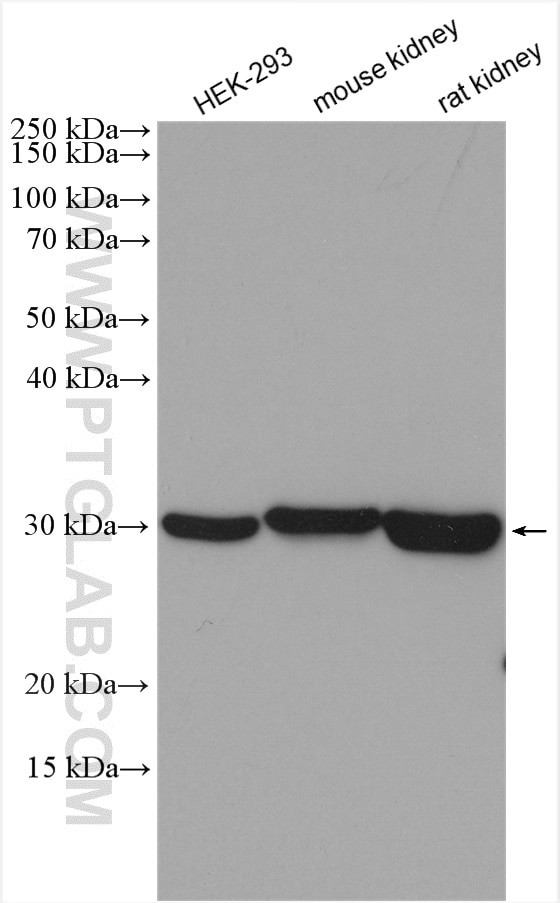 CA7 Antibody in Western Blot (WB)