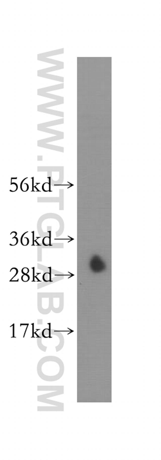 CA7 Antibody in Western Blot (WB)