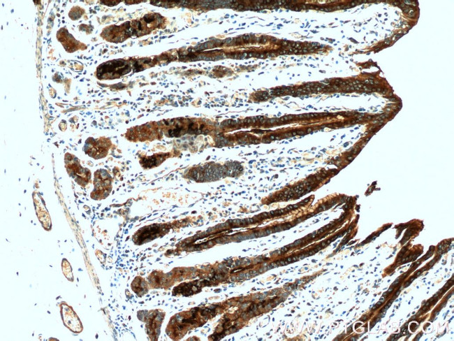 TFF2 Antibody in Immunohistochemistry (Paraffin) (IHC (P))