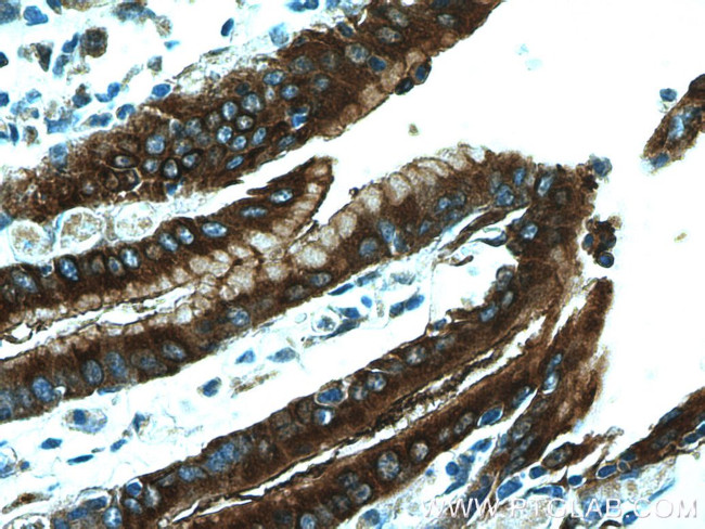 TFF2 Antibody in Immunohistochemistry (Paraffin) (IHC (P))