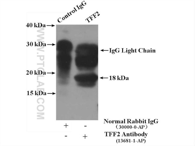 TFF2 Antibody in Immunoprecipitation (IP)