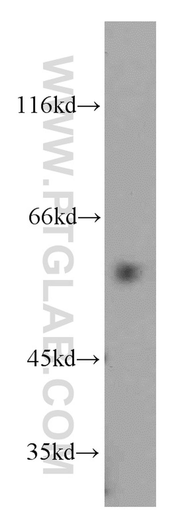 VEGFR-1/FLT-1 Antibody in Western Blot (WB)