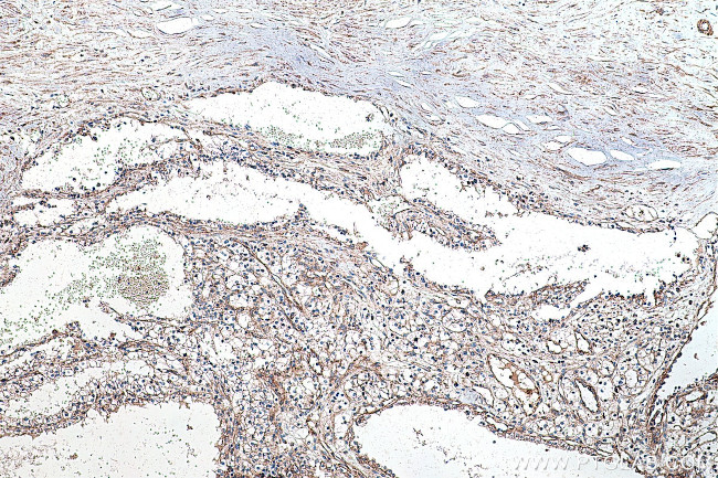 VEGFR-1/FLT-1 Antibody in Immunohistochemistry (Paraffin) (IHC (P))