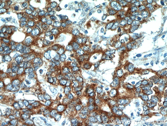 NEDD4L Antibody in Immunohistochemistry (Paraffin) (IHC (P))