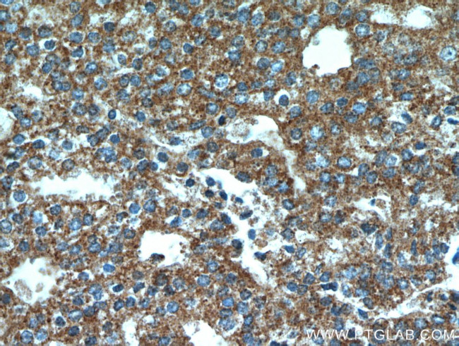 NEDD4L Antibody in Immunohistochemistry (Paraffin) (IHC (P))