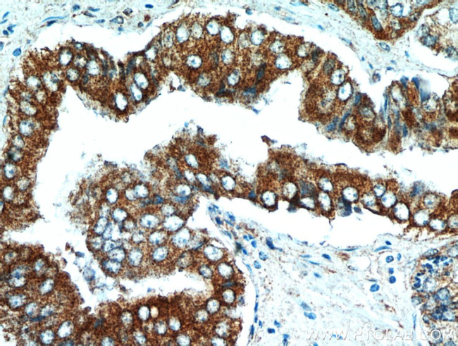 NEDD4L Antibody in Immunohistochemistry (Paraffin) (IHC (P))