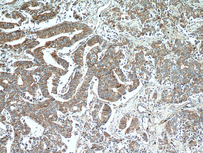 NEDD4L Antibody in Immunohistochemistry (Paraffin) (IHC (P))