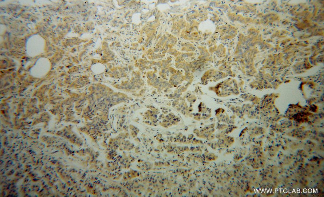 NEDD4L Antibody in Immunohistochemistry (Paraffin) (IHC (P))