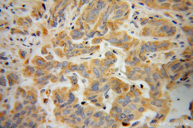 NEDD4L Antibody in Immunohistochemistry (Paraffin) (IHC (P))