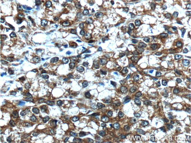 NEDD4L Antibody in Immunohistochemistry (Paraffin) (IHC (P))