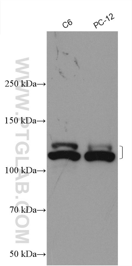 NEDD4L Antibody in Western Blot (WB)