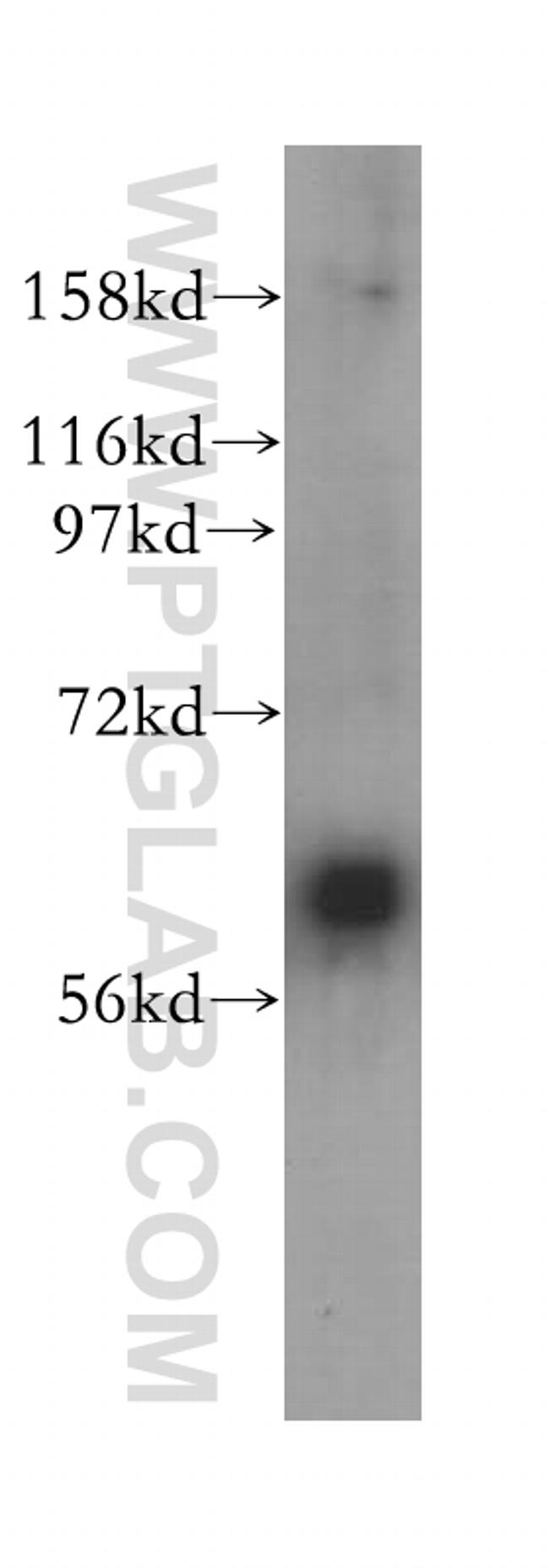 FMO5 Antibody in Western Blot (WB)