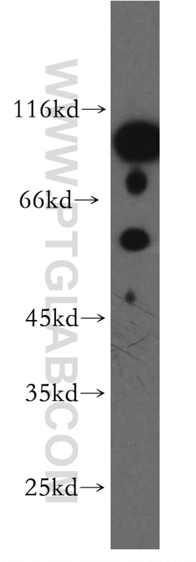 DGCR2 Antibody in Western Blot (WB)