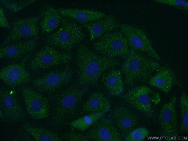 Carboxypeptidase E Antibody in Immunocytochemistry (ICC/IF)