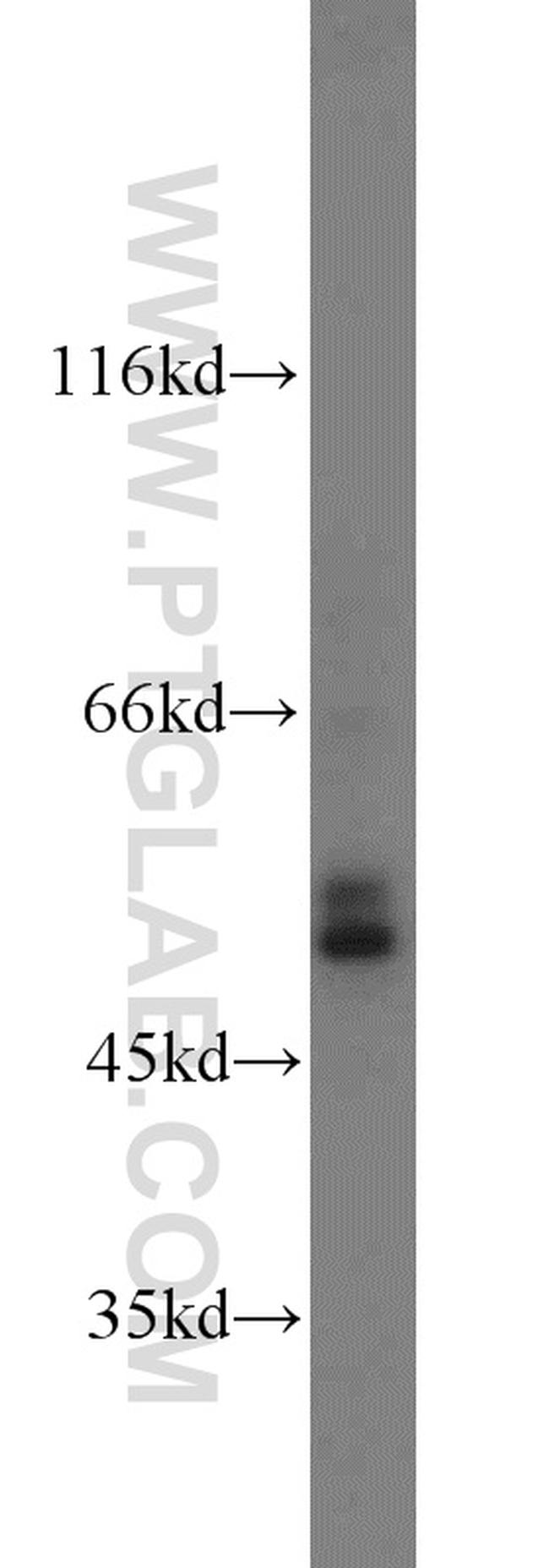 Carboxypeptidase E Antibody in Western Blot (WB)