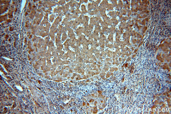 CBR4 Antibody in Immunohistochemistry (Paraffin) (IHC (P))