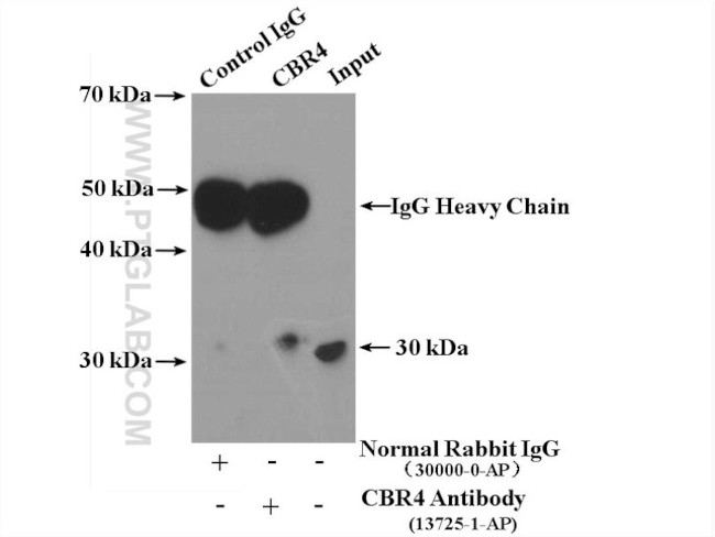 CBR4 Antibody in Immunoprecipitation (IP)