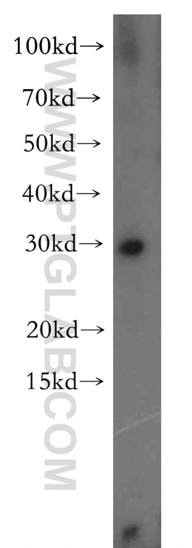 CBR4 Antibody in Western Blot (WB)