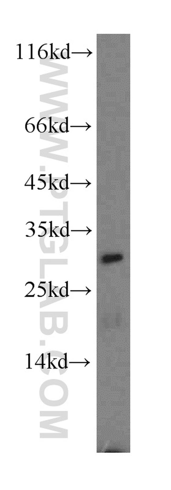 CBR4 Antibody in Western Blot (WB)